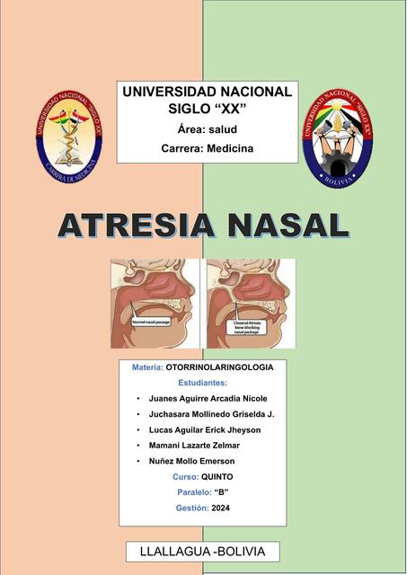 ATRESIA NASAL