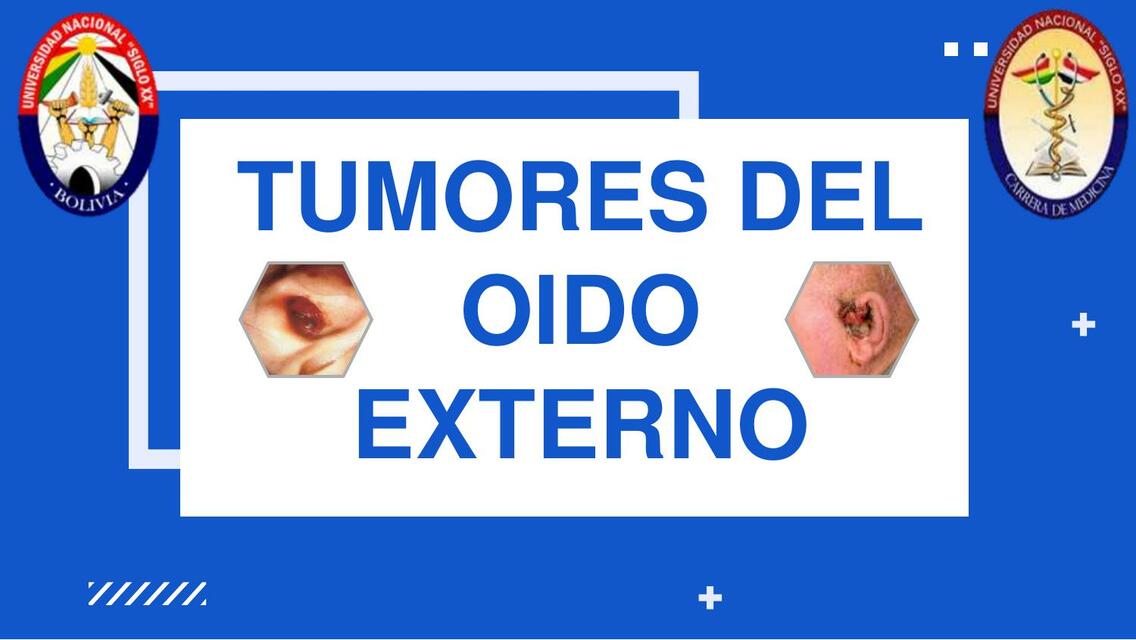 TUMORES DEL OIDO EXTERNO