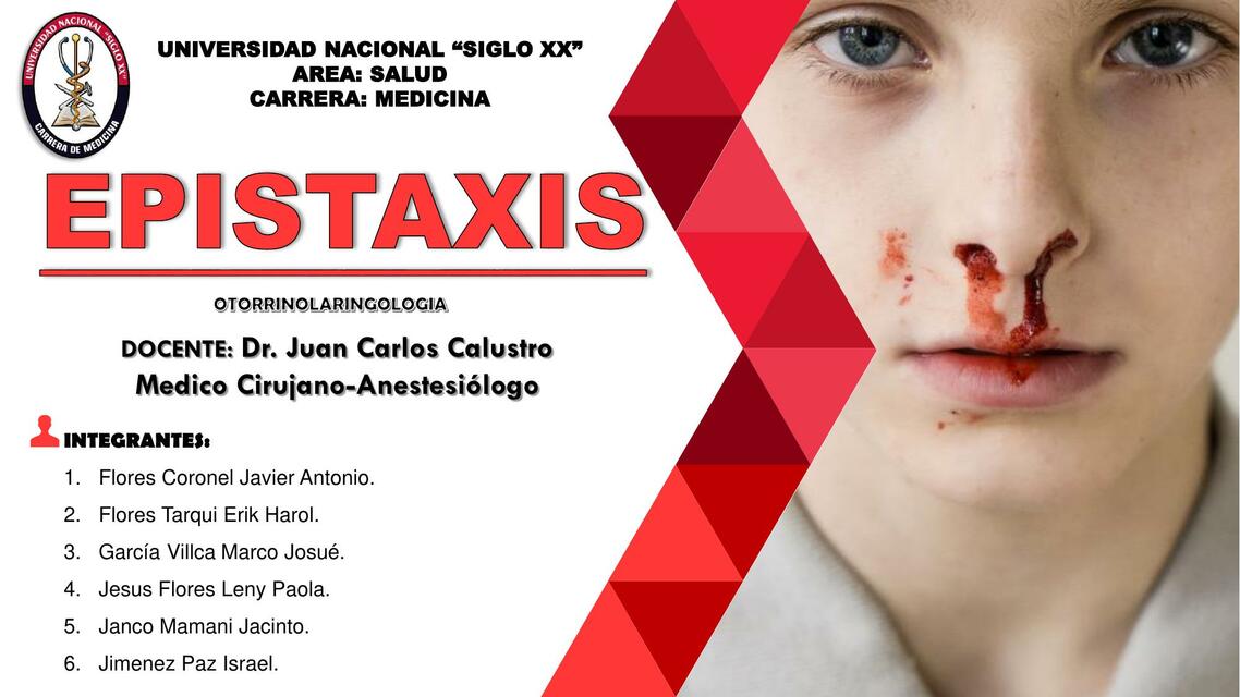 DIAPOSITIVAS EPISTAXIS