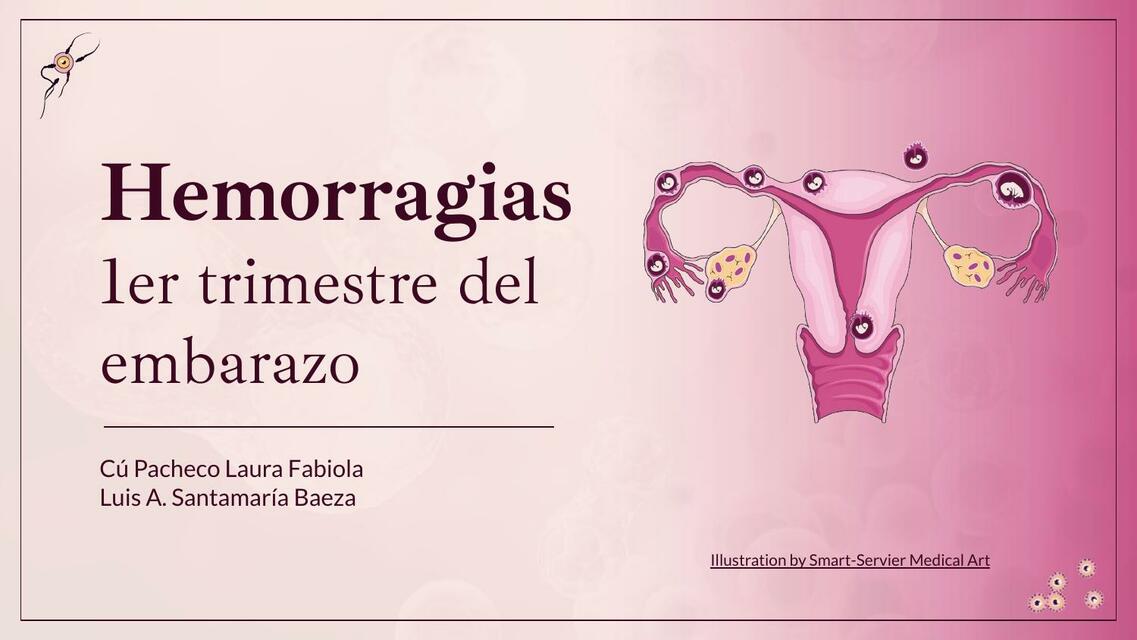 hemorragias al principio del embarazo