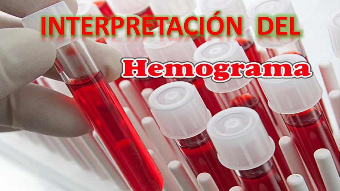 Interpretación del hemograma 