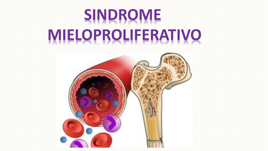 Síndrome mieloproliferativo 