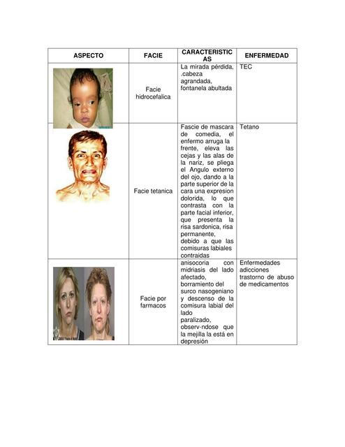 Facies semiologia