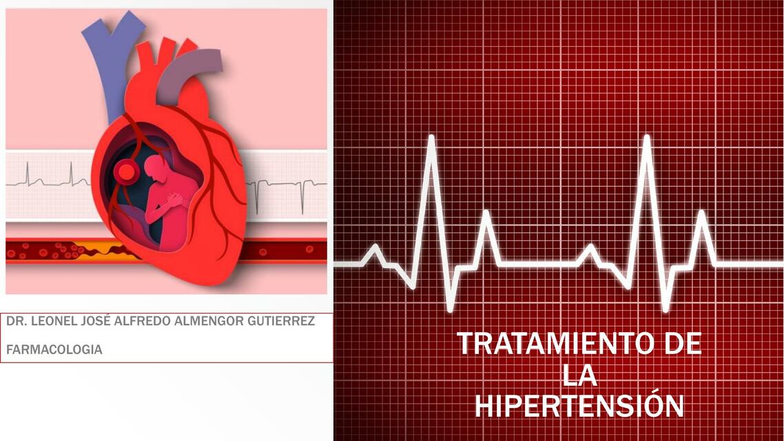 TRATAMIENTO DE LA HIPERTENSIÓN