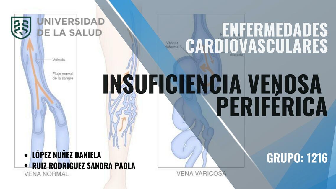 INSUFICIENCIA VENOSA PERIFERICA