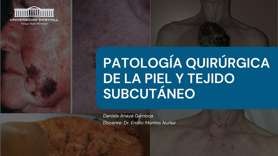 Patología quirúrgica de la piel y tejido subcuta