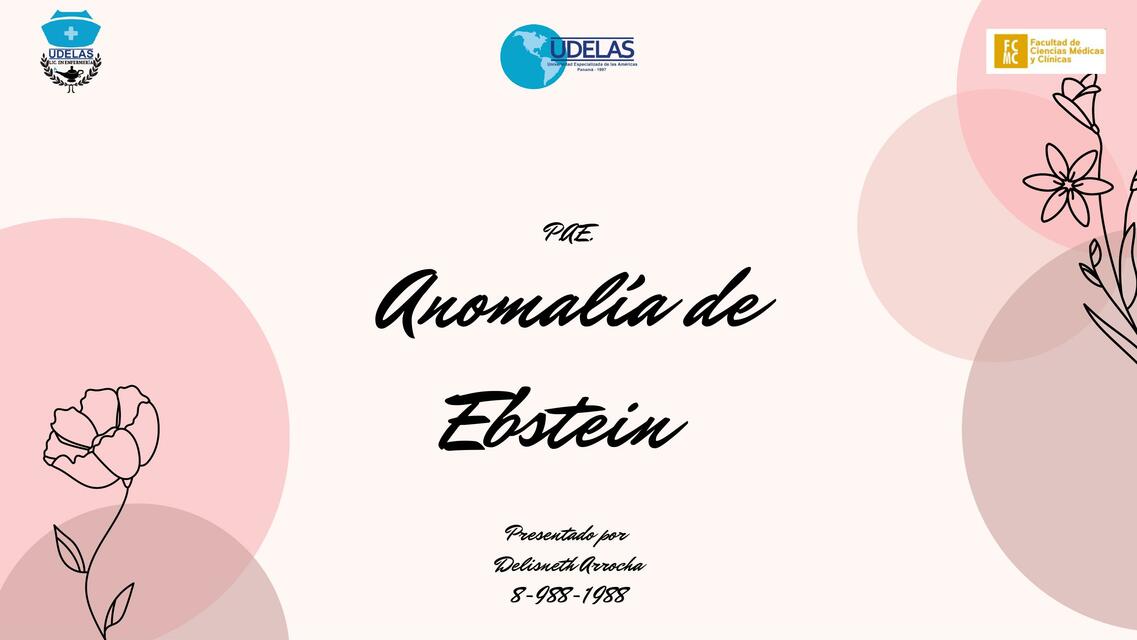 Anomalia de ebstein