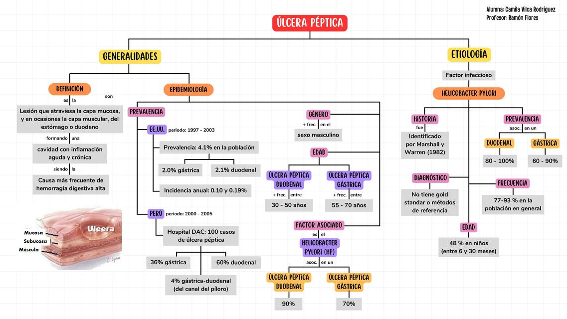 Esquema Úlcera péptica