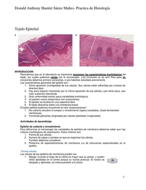 tej epit y glandular