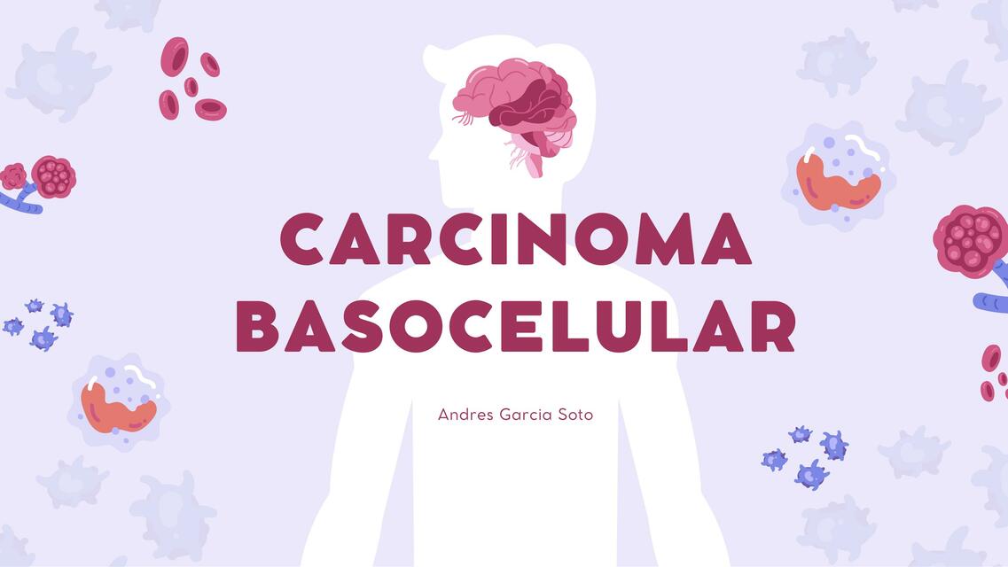 Carcinoma basocelular