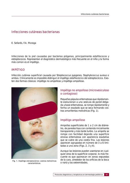 IMPETIGO