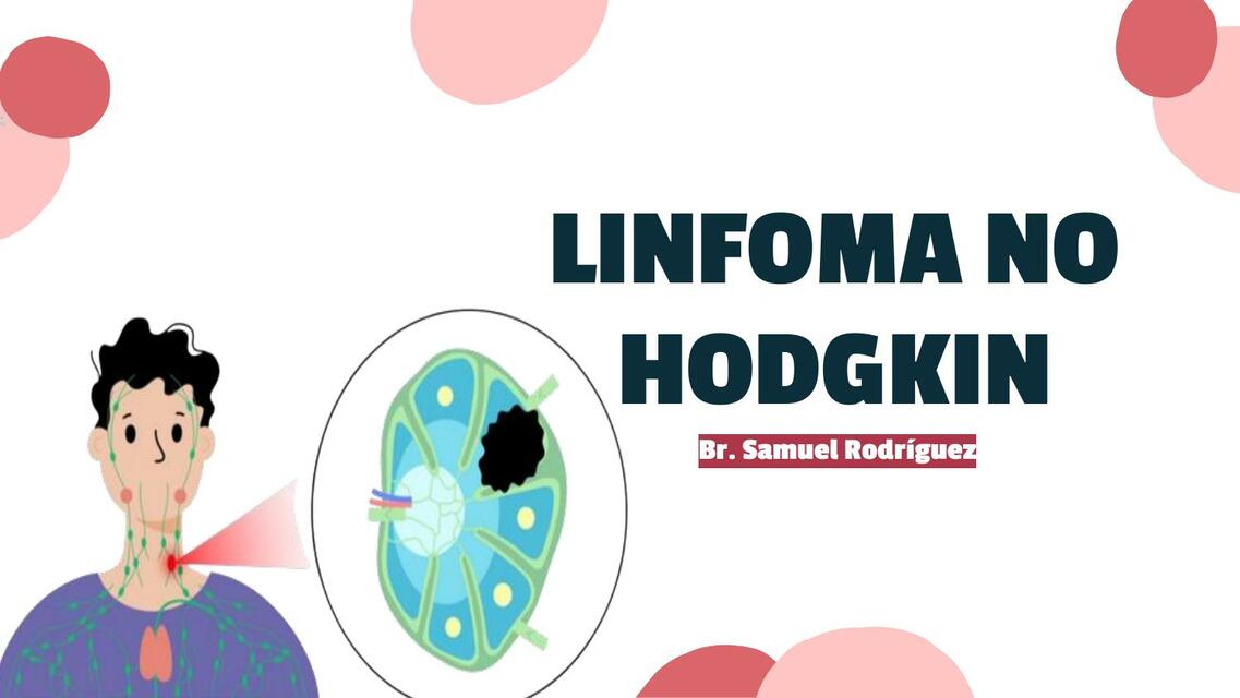 Linfoma no Hodgkin