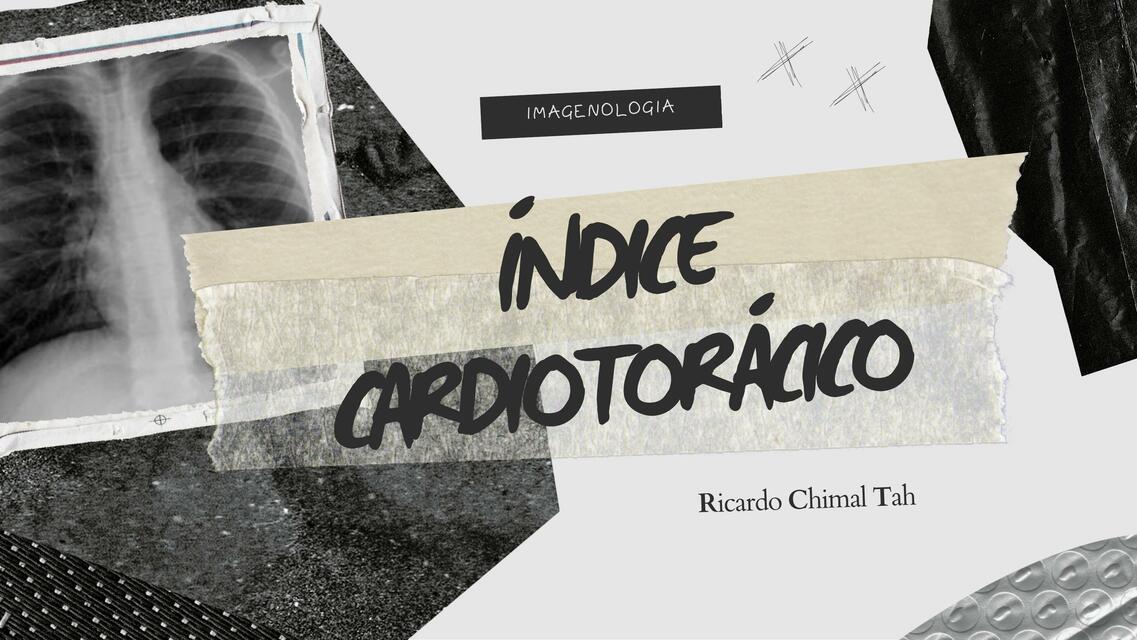 Índice cardiotorácico