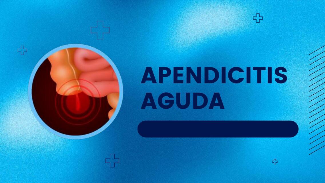 APENDICITIS AGUDA