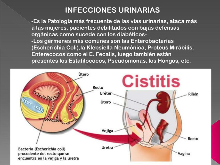 INFECCIONES URINARIAS