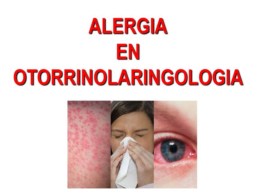 ALERGOLOGIA EN OTORRINOLARINGOLOGIA