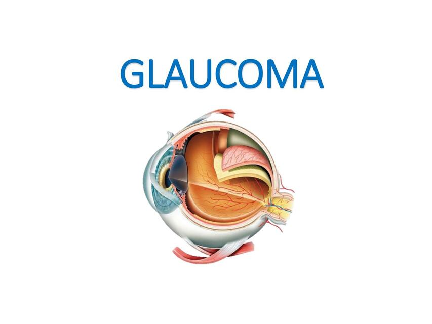 5 GLAUCOMA