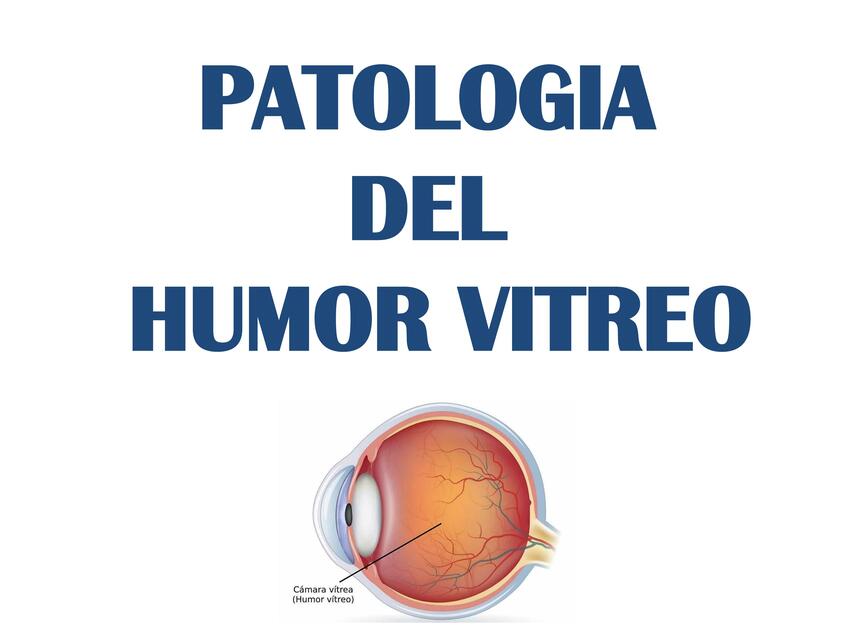 Patología del humor vitreo