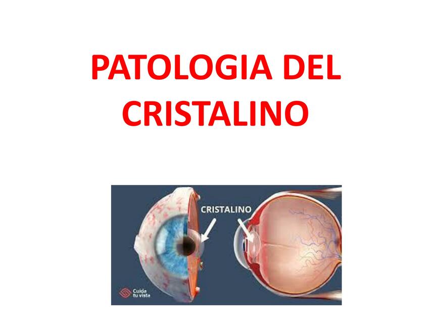 CRISTALINO