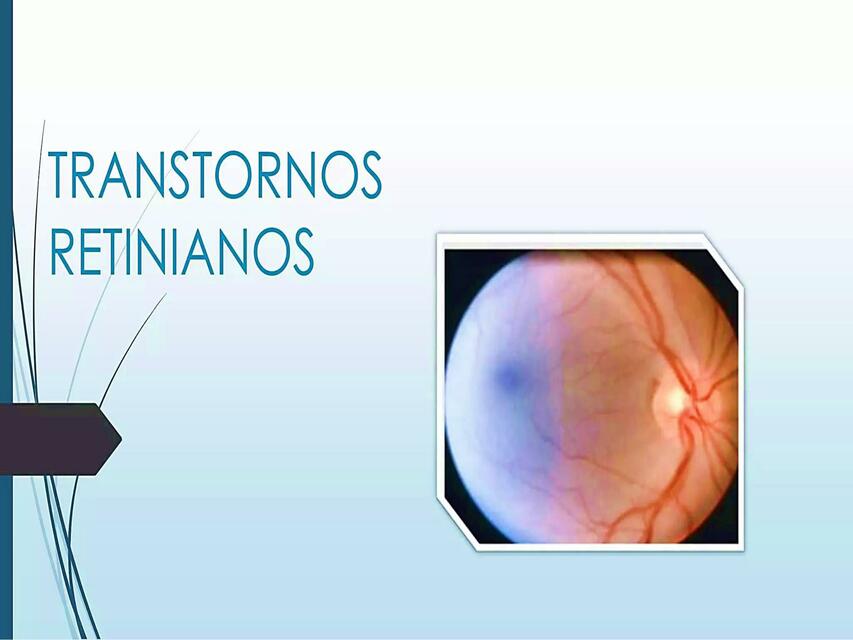 Transtornos retinianos