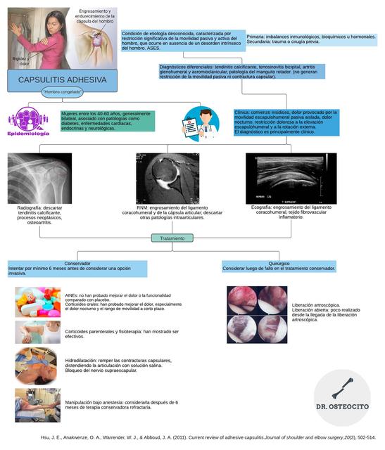 Capsulitis adhesiva