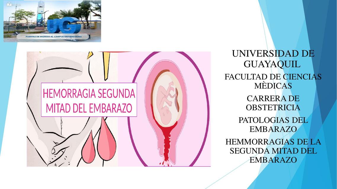 1 PATOLOGIAS DEL EMBARAZO PLACENTA PREVIA 2