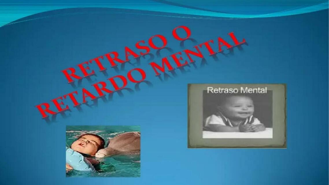 retrasado mental