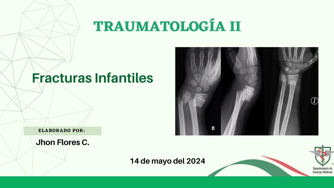 FRACTURAS INFANTILES - FISIS