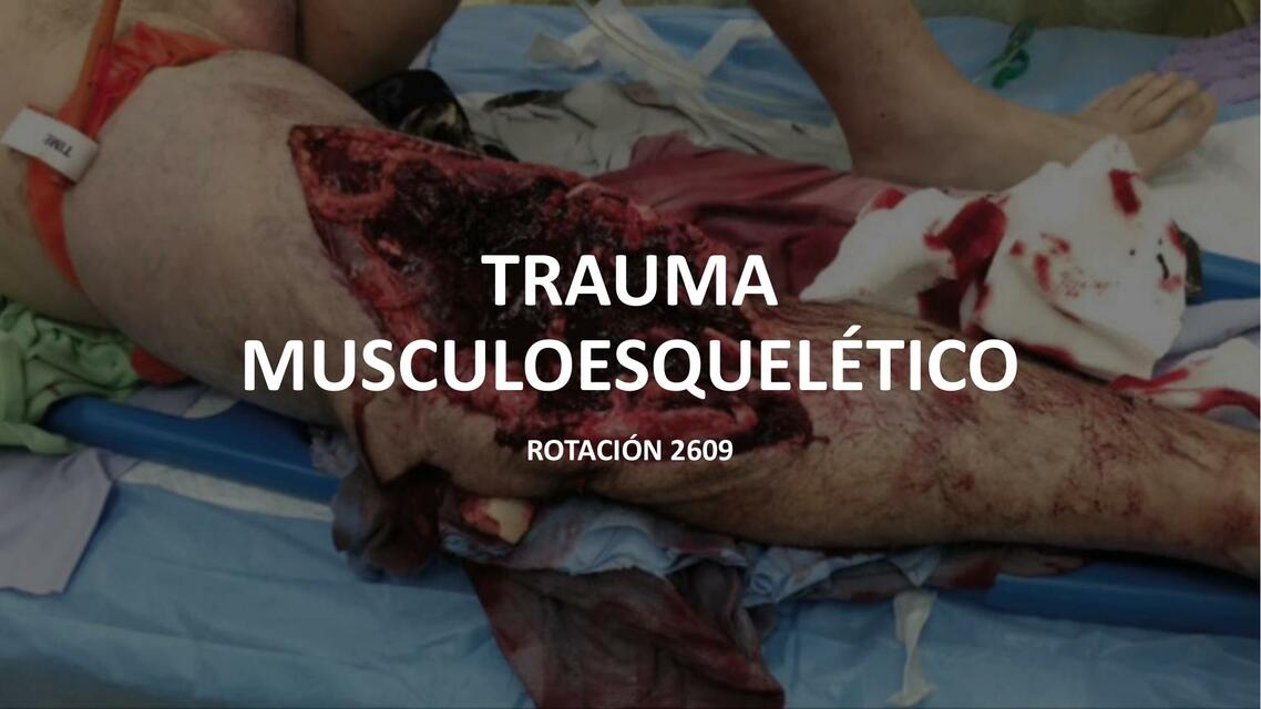 Trauma musculoesqueletico