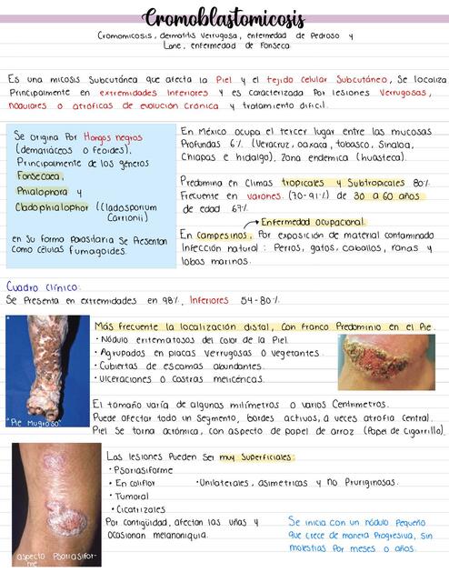 Cromoblastomicosis 