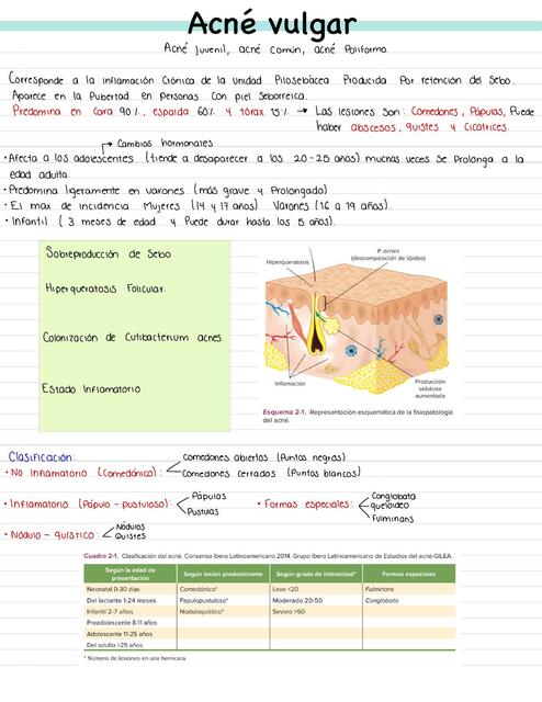 Acné vulgar