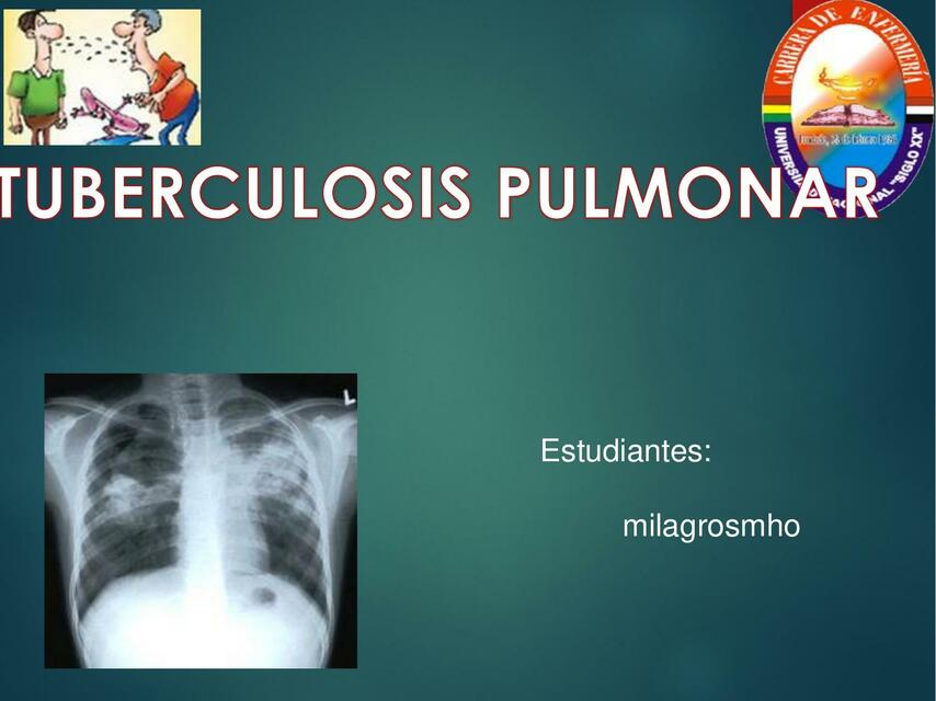 tuberculosis