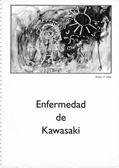  Enfermedad de Kawasaki