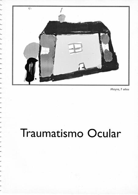 Traumatismo Ocular