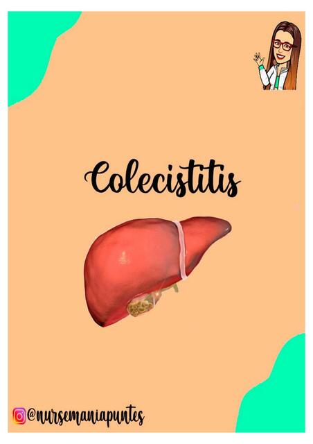 Colecistitis