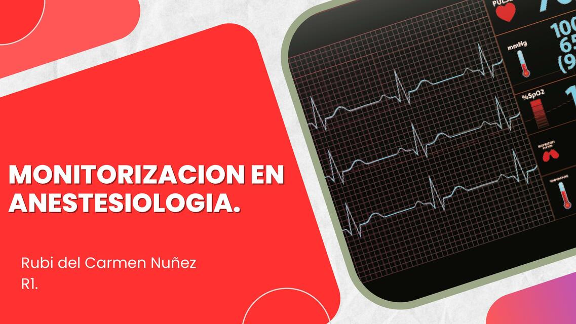 MoniTORIZACION EN ANESTESIOLOGIA