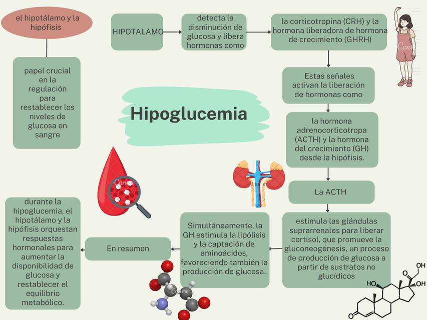 DOC WA Hipoglucemia