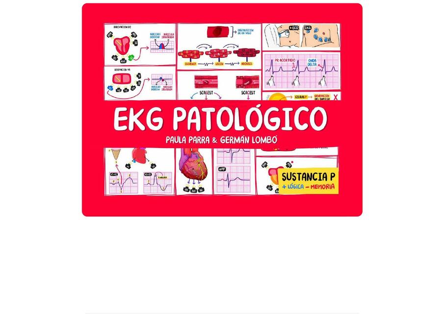 ekg patologico sustancia p compress