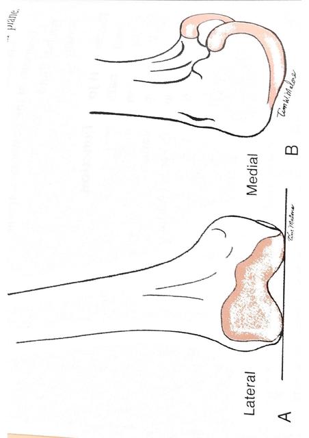 Esquemas de Rodilla