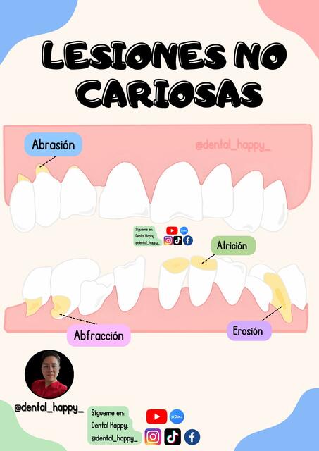 Lesiones no cariosas