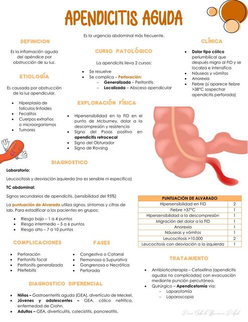 Apendicitis Aguda