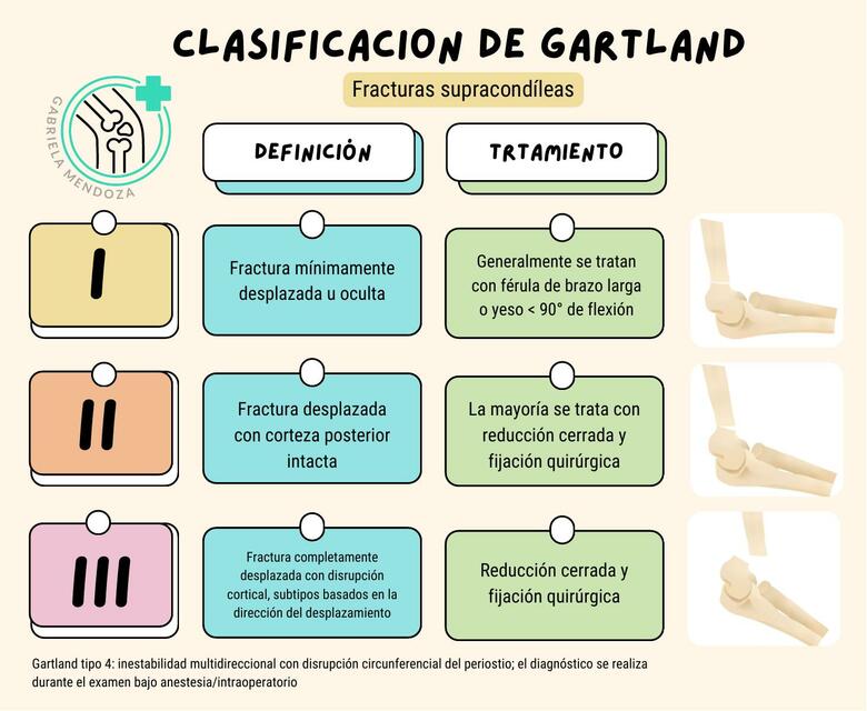 Clasificación de Gartland - Fractura Supracondílea | Gaby Mendoza | uDocz