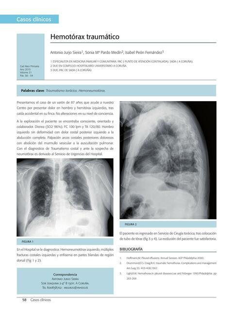 Hemotórax traumático 