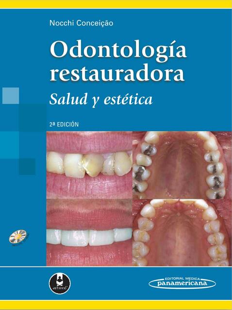 Odontología restauradora 