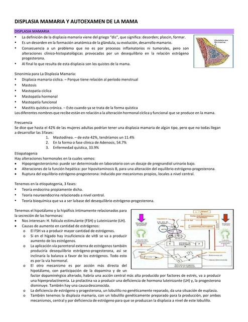 Displasia Mamaria y Autoexamen