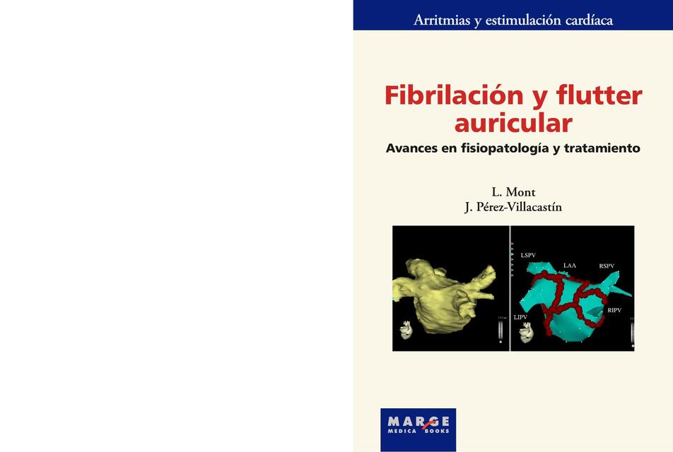 FIBRILACIÓN Y FLUTTER AURICULAR | Julio López | uDocz