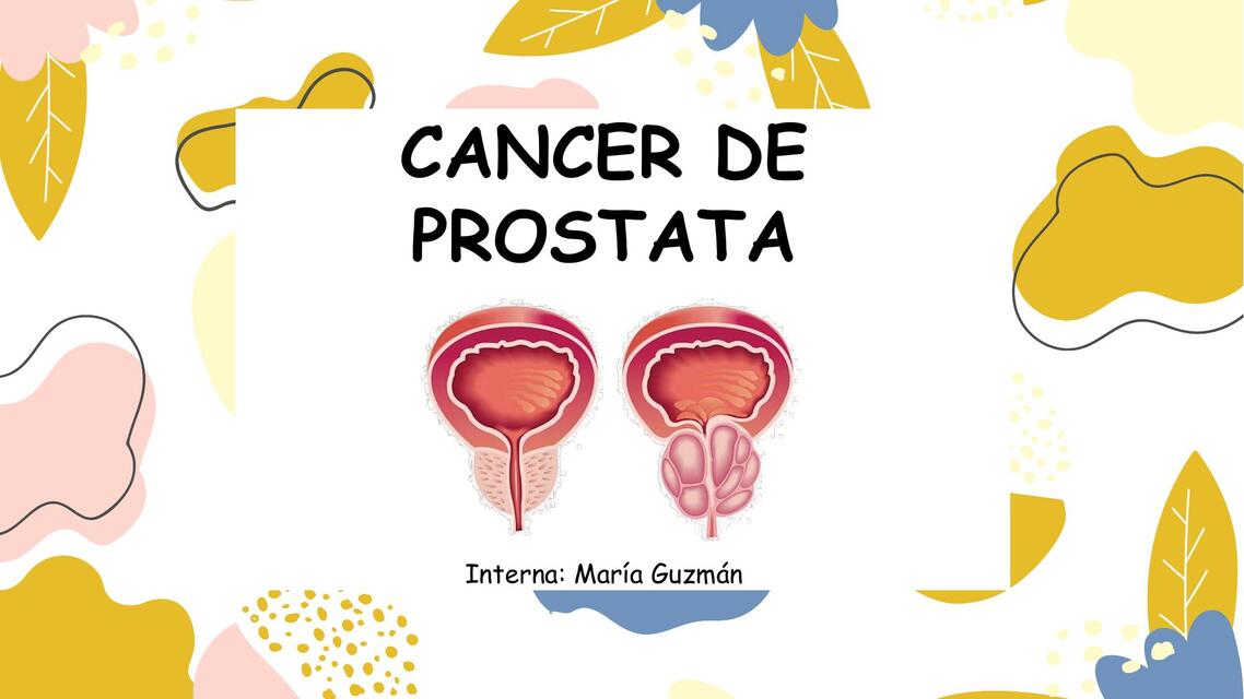 CANCER DE PROSTATA