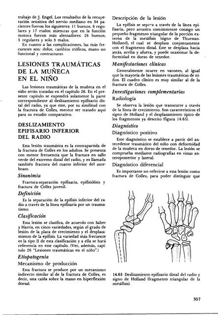 Fractura en niños