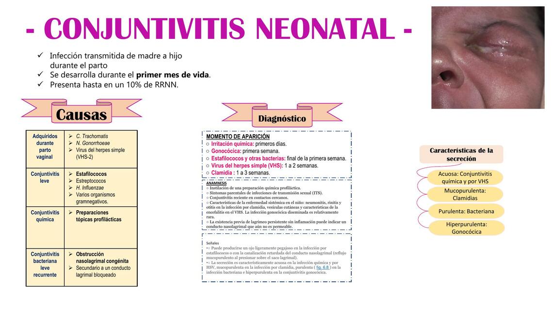 CONJUNTIVITIS NEONATAL