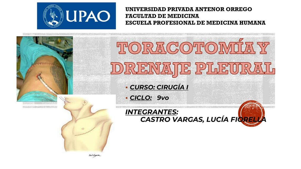 TORACOTOMÍA Y DRENAJE PLEURAL